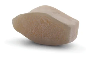 Craniomaxillofacial (CMF) Solutions