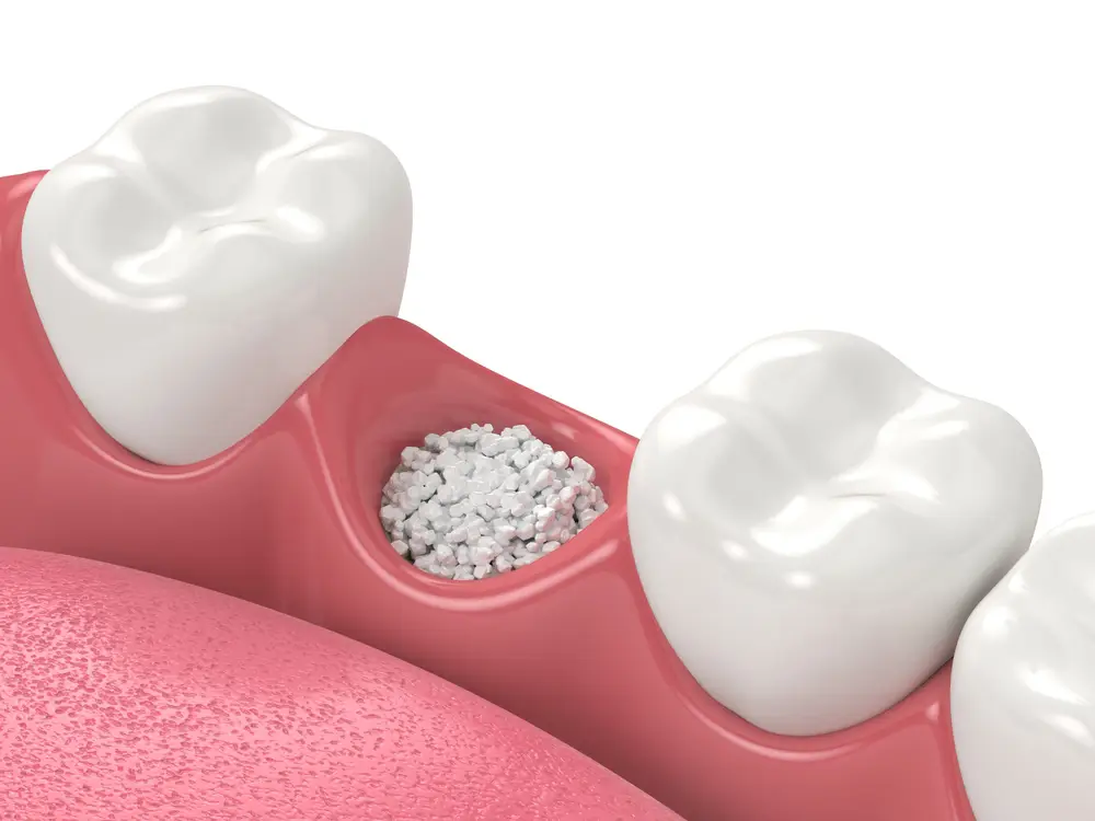 Bone Grafts & Biologics